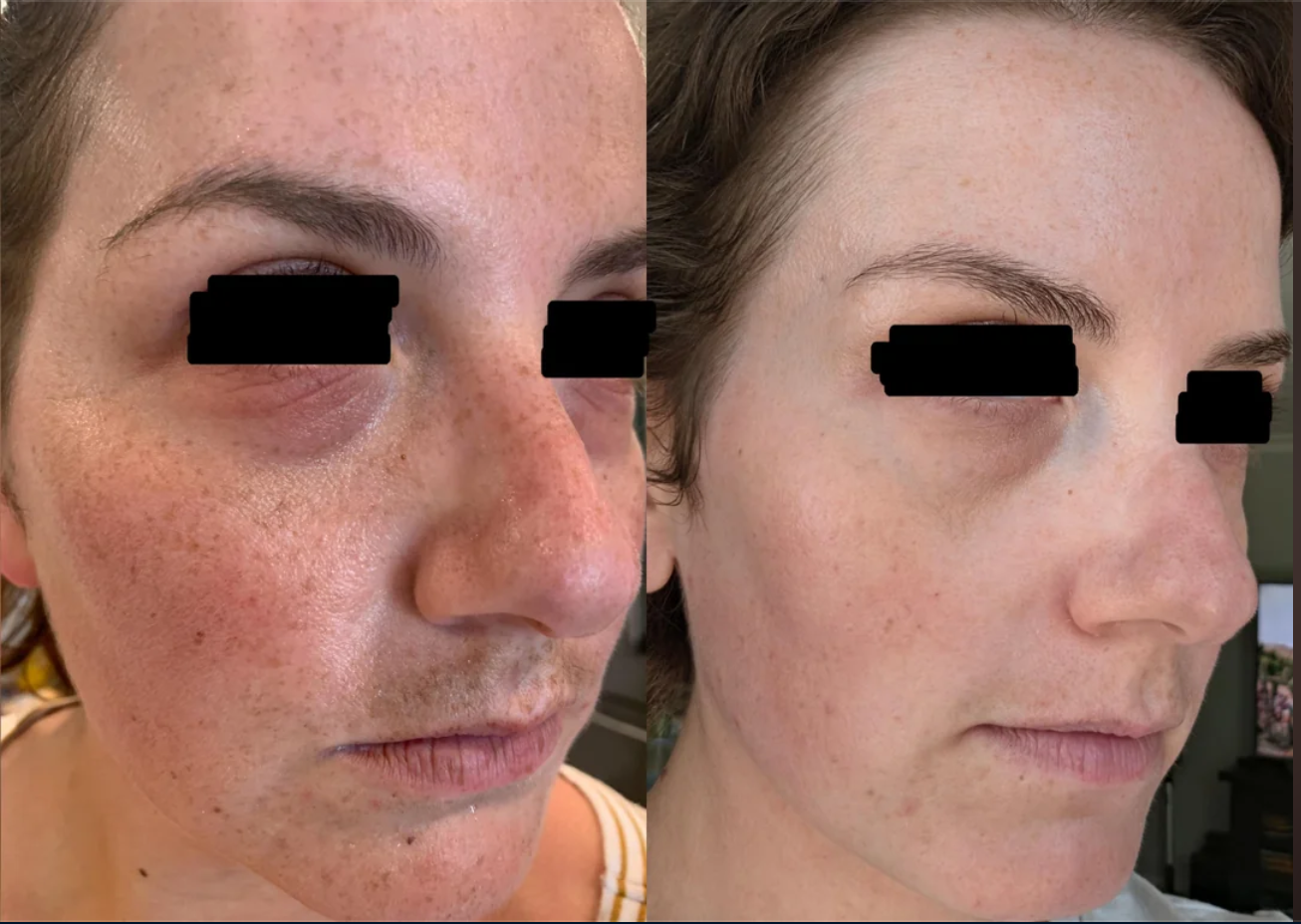 Side-by-side photos submitted by Hailie at ages 30 and 34, with her eyes obscured